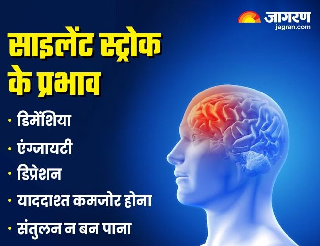 Silent Brain Stroke Effects