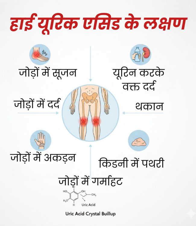 High Uric Acid Symptoms (2)