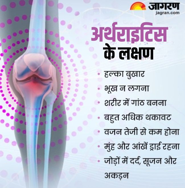 Arthritis Symptoms