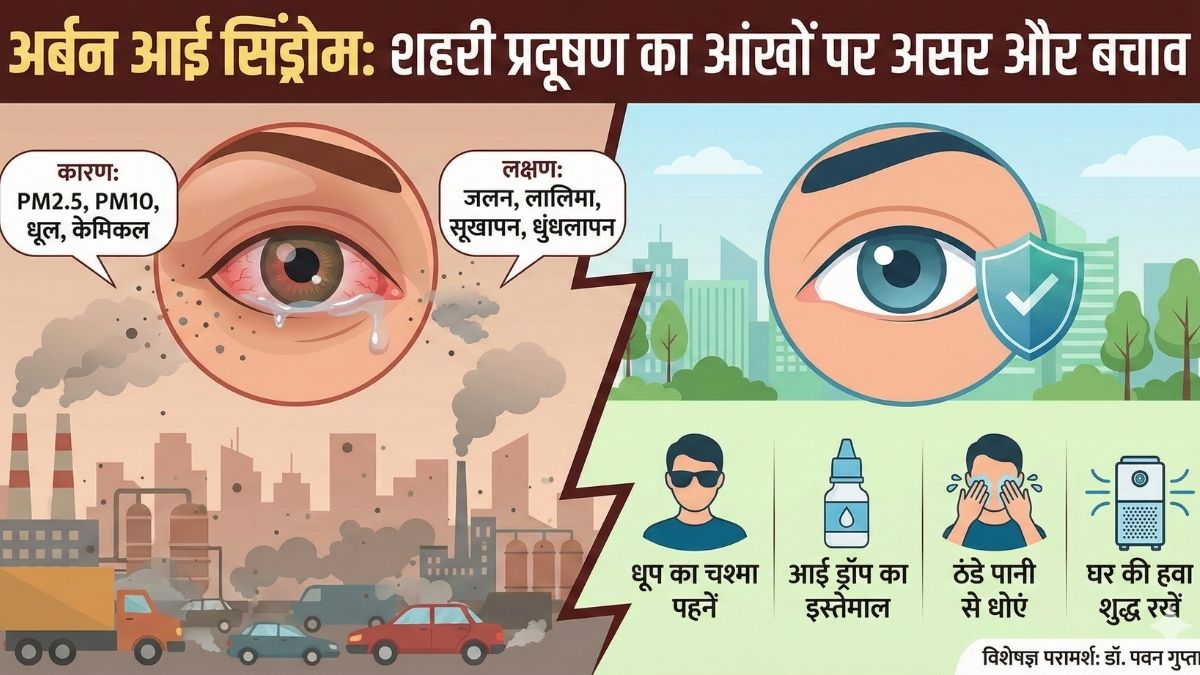 Urban Eye Syndrome (1)