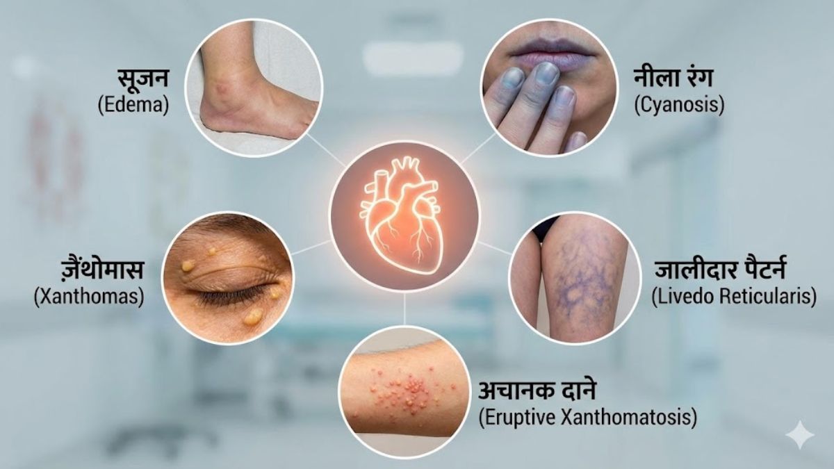 Heart Disease Symptoms on skin