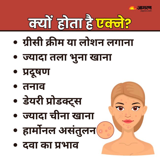 acne causes