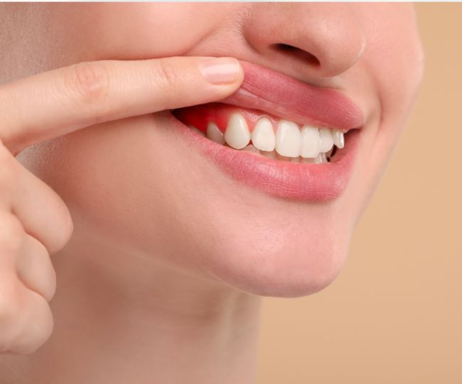 Guava Leaves for teeth and gums