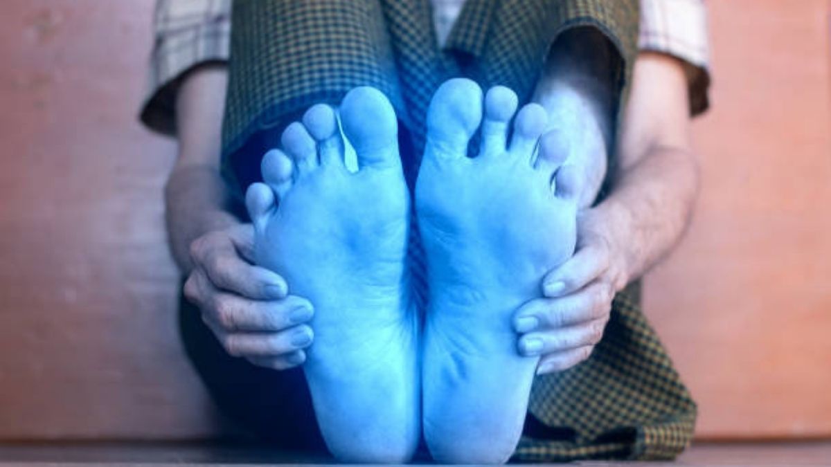 Cold Feet