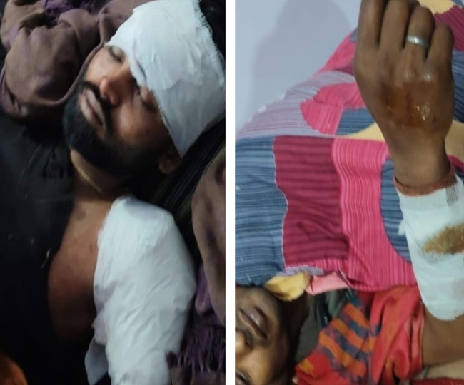 prayagraj leopard attake injured