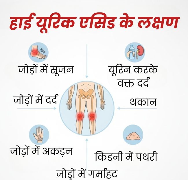High Uric Acid Symptoms (2)