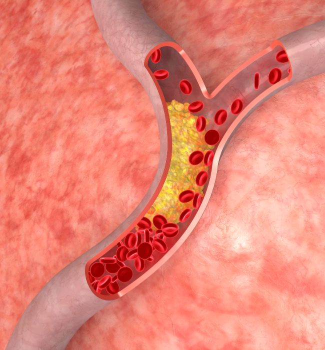 eggs Risk of increasing cholesterol
