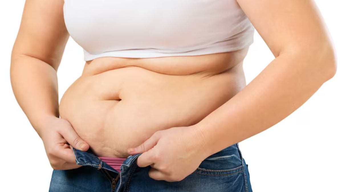 Belly Fat (3)