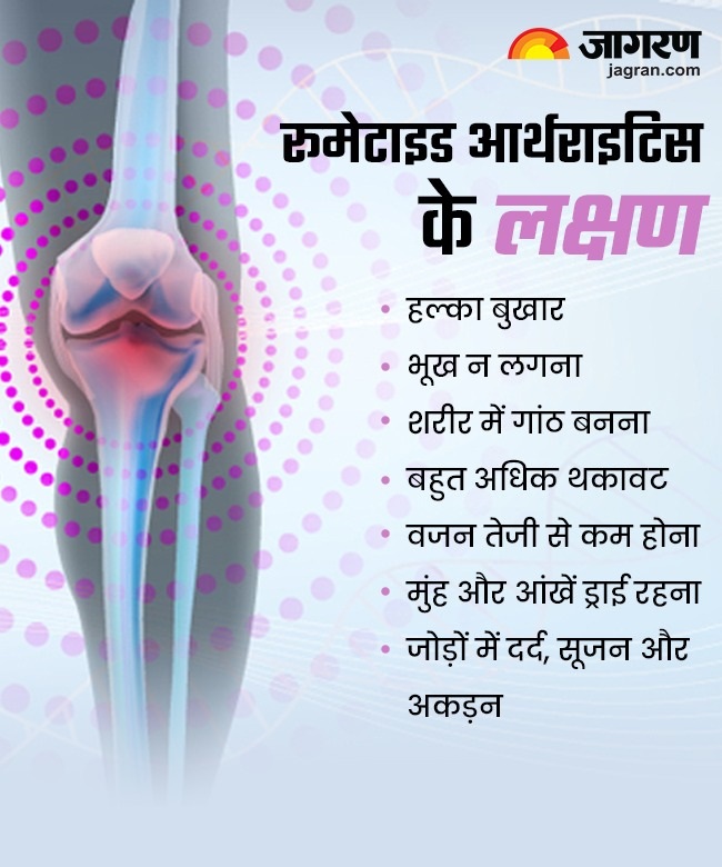 Rheumatoid Arthritis Symptoms 