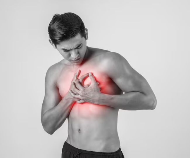 Heart Attack