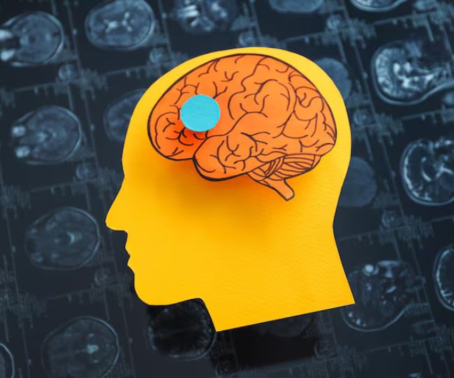Parkinsons Disease