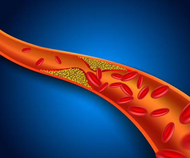 Cholesterol