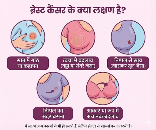 breast cancer (2)