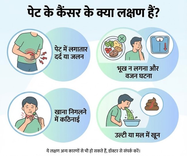 stomach cancer (1)