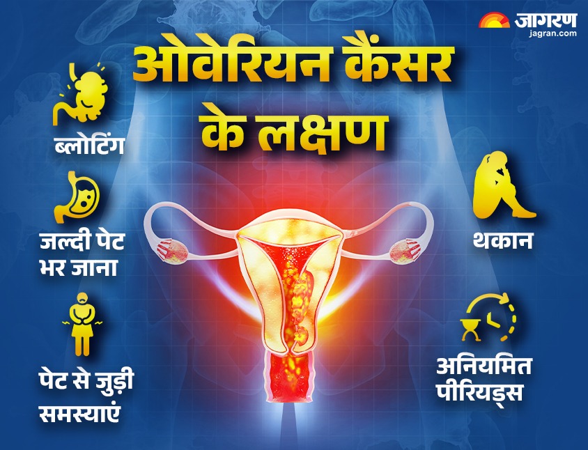 Why is ovarian cancer increasing in women under 40