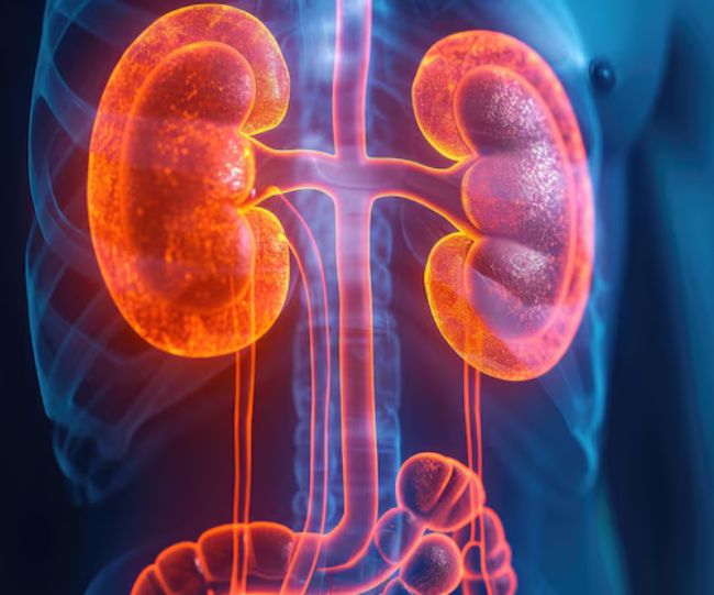 Chronic Kidney Disease