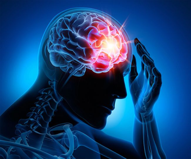 Toxic Air Increases Alzheimers Risk