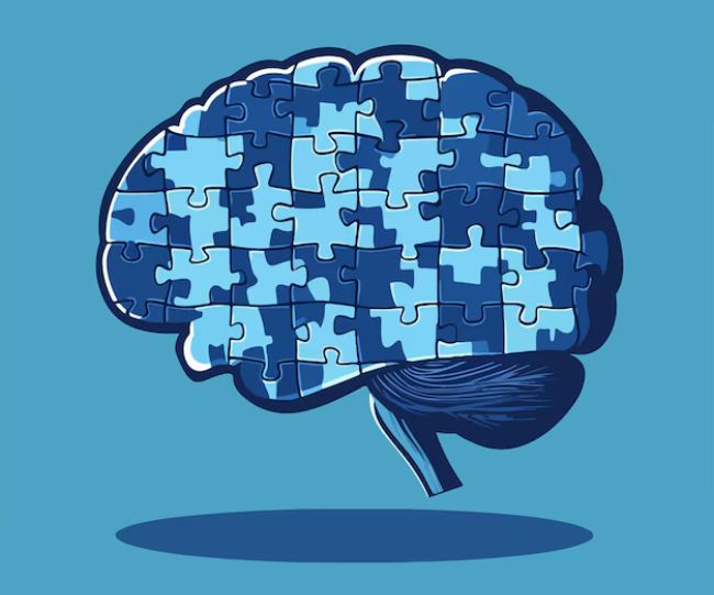 Alzheimer brain