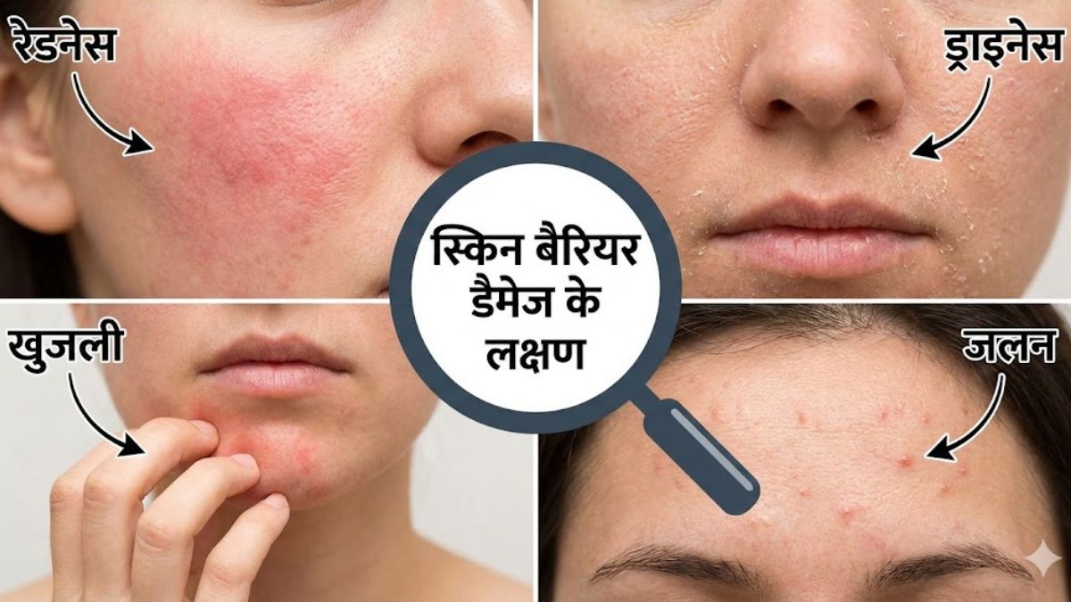 Damaged Skin barrier