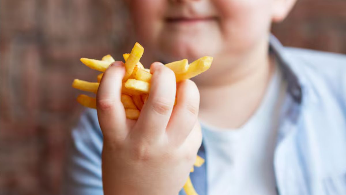 Childhood obesity (1)