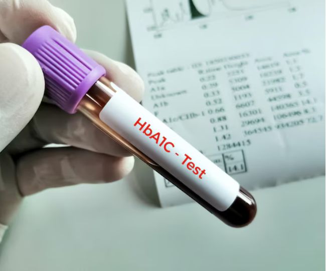 Normal fasting sugar but high HbA1C