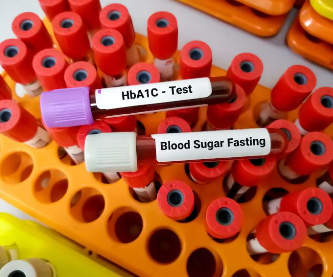blood sugar fasting