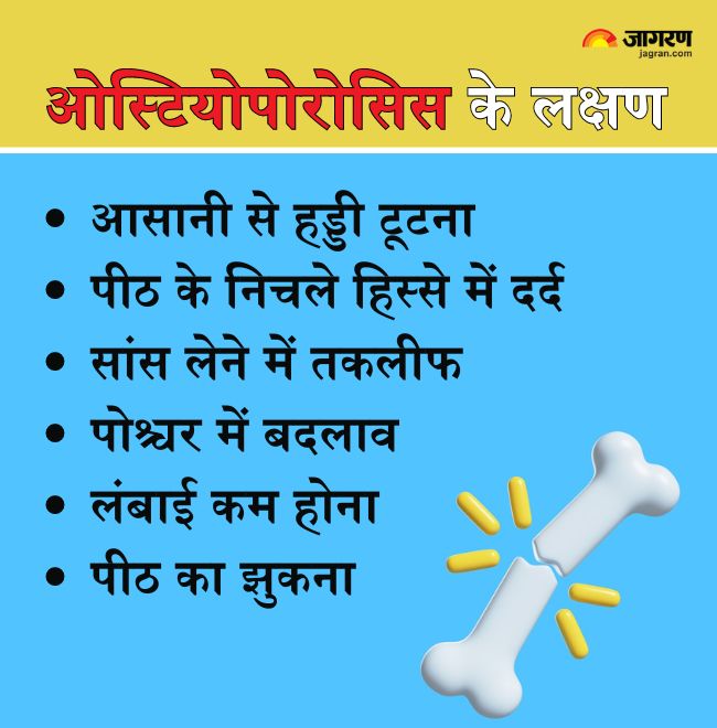 Osteoporosis Symptoms