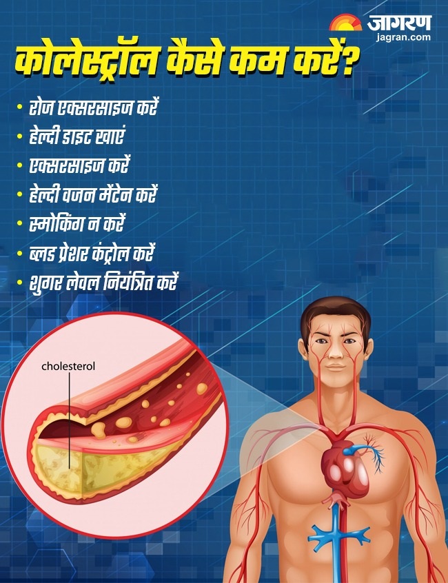 Cholesterol low