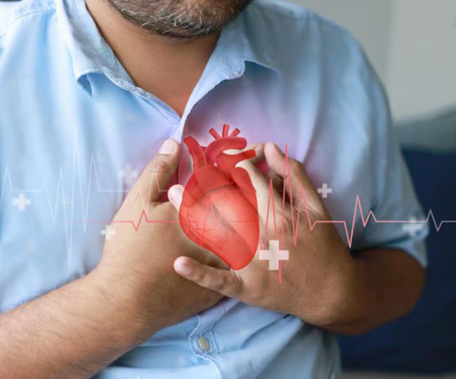 Post Heart Attack Care