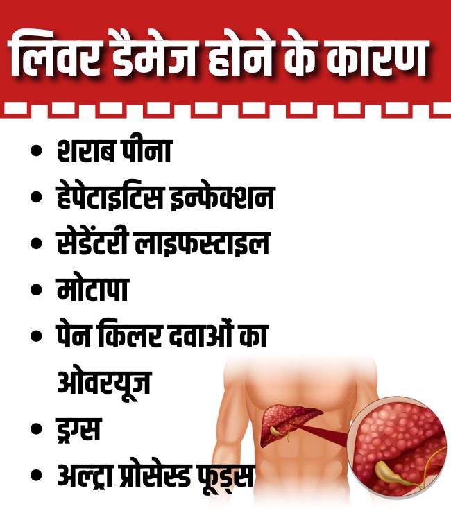 Liver Damage Risk Factors