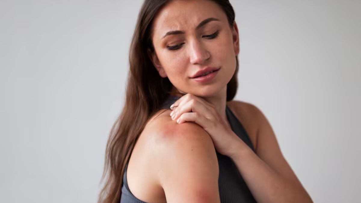 Skin Diseases