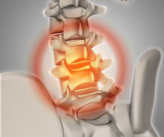 Ankylosing Spondylitis symptoms