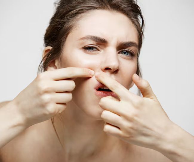 pimple