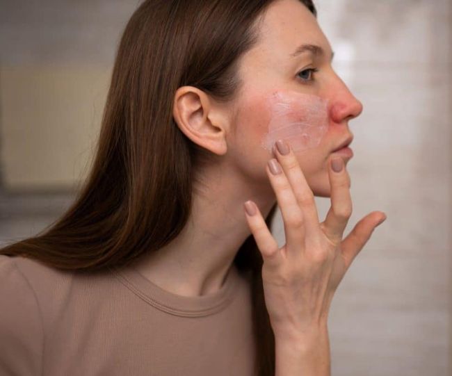 Dry skin tips