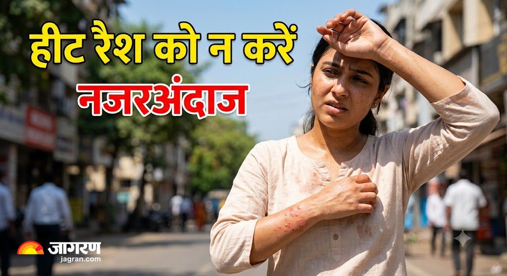 heat rash prevention