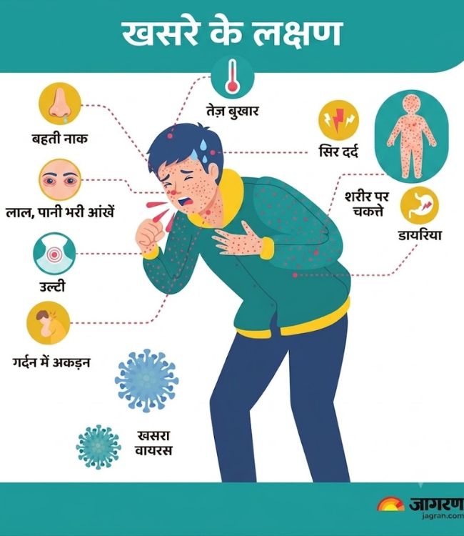 Measles Symptoms