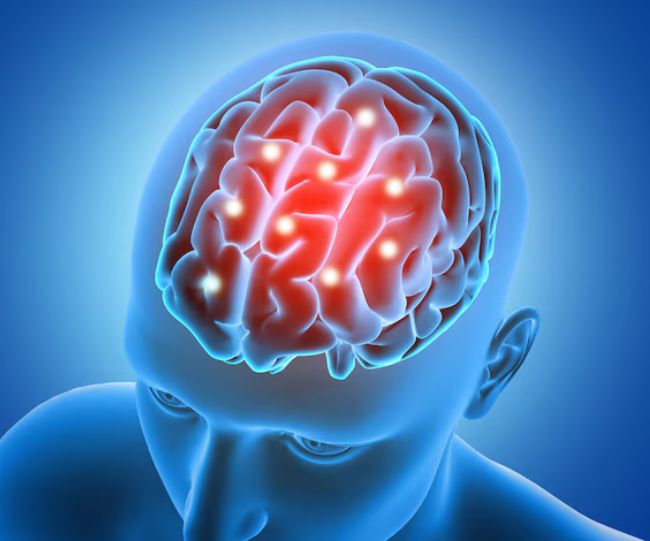 stroke risk