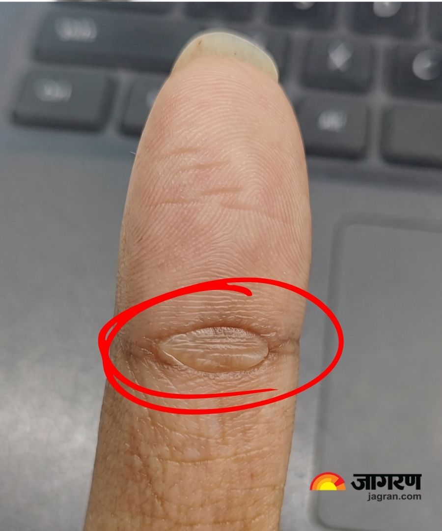 anguthe ki rekha ka matlab