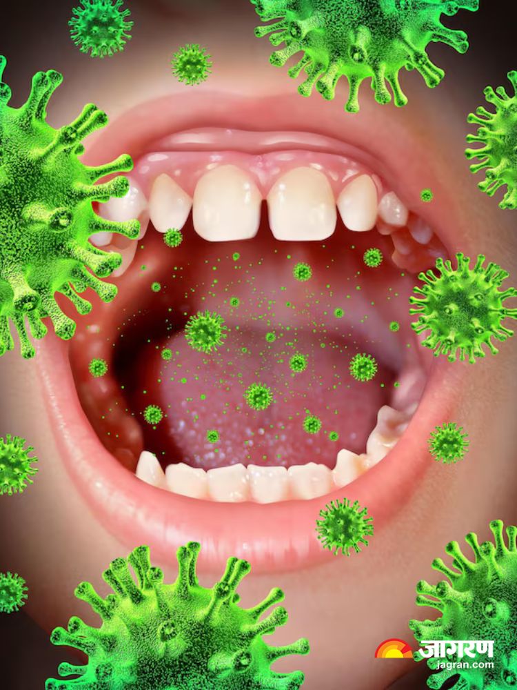 Oral Cancer