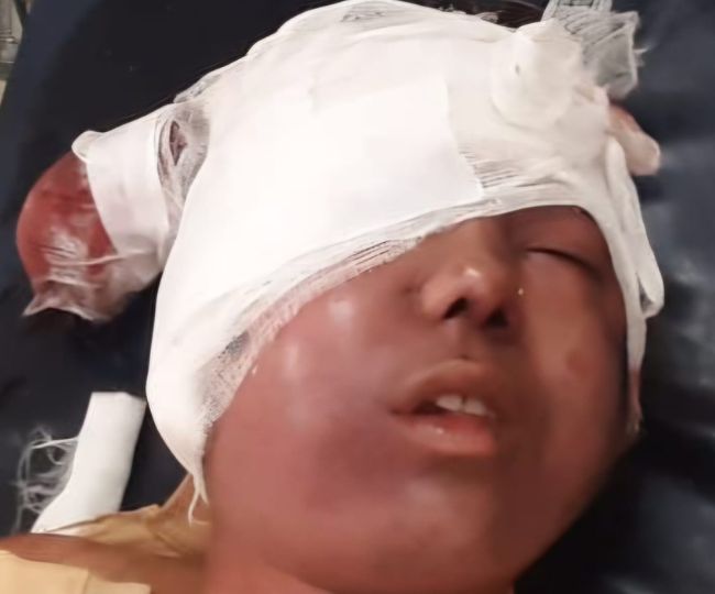 Women Injured in Leopard Attack